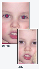 Results from Red-eye removal software.